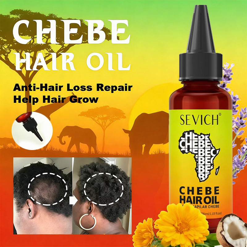 Beard Oil Growth - Chebe Fast Hair Growth Oil Africa