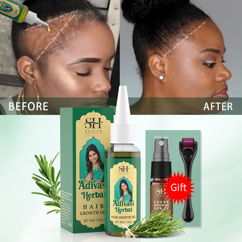 Ayurvedic Hair Growth Oil Indi - Beard Oil Growth ulasan dan harga