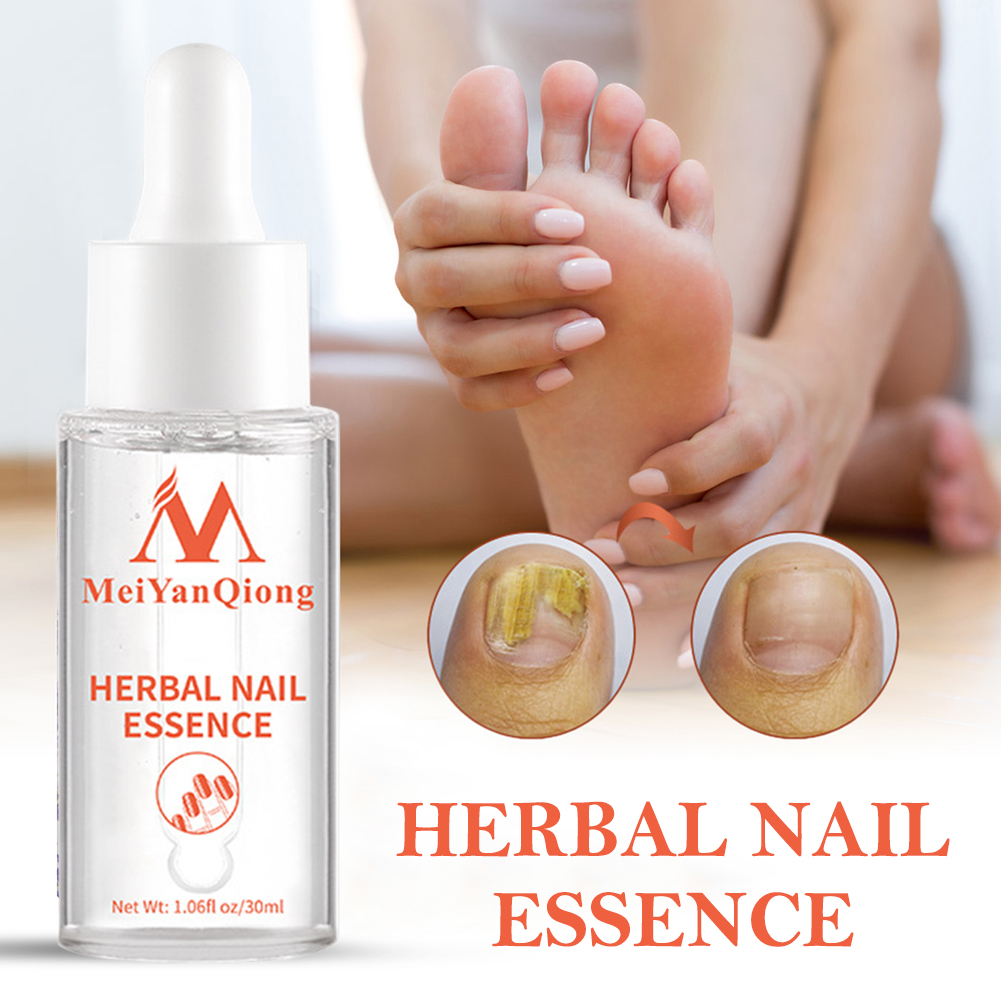 Foot Grooming Gel Anti  Nail W - Mens Grooming Treatment ulasan dan harga