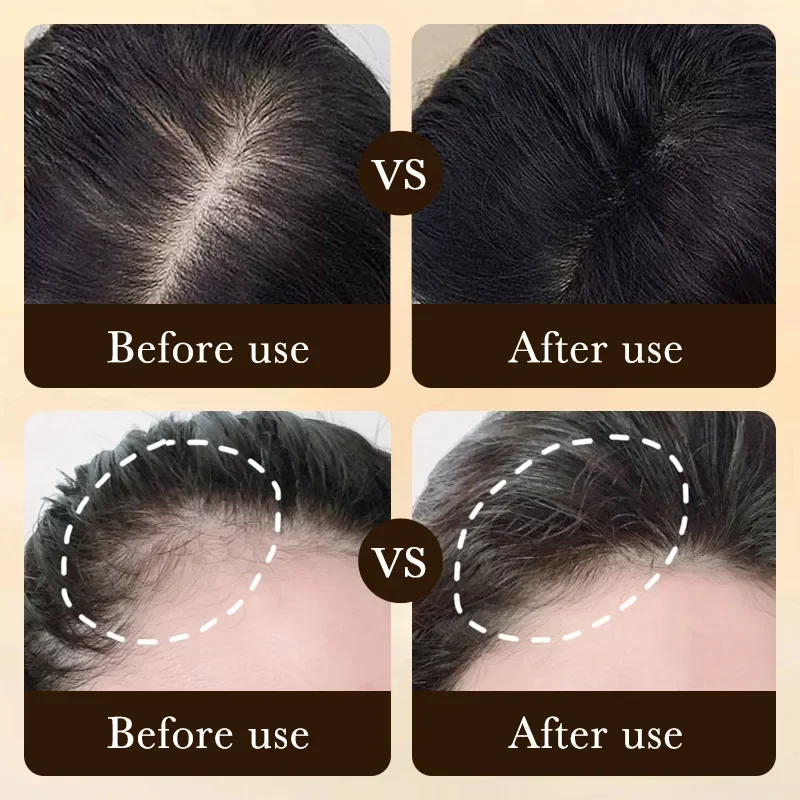 Biotin Fast Hair Growth Oil Pr - Beard Oil Growth ulasan dan harga