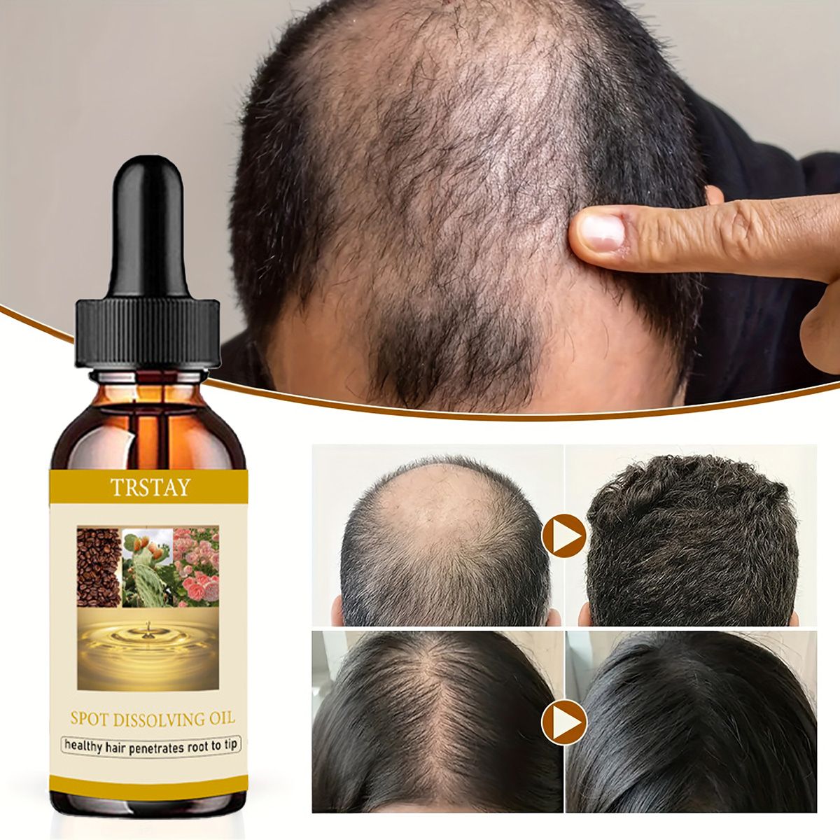 50ML Beard Growth Oil Anti Alo - Beard Oil Growth ulasan dan harga