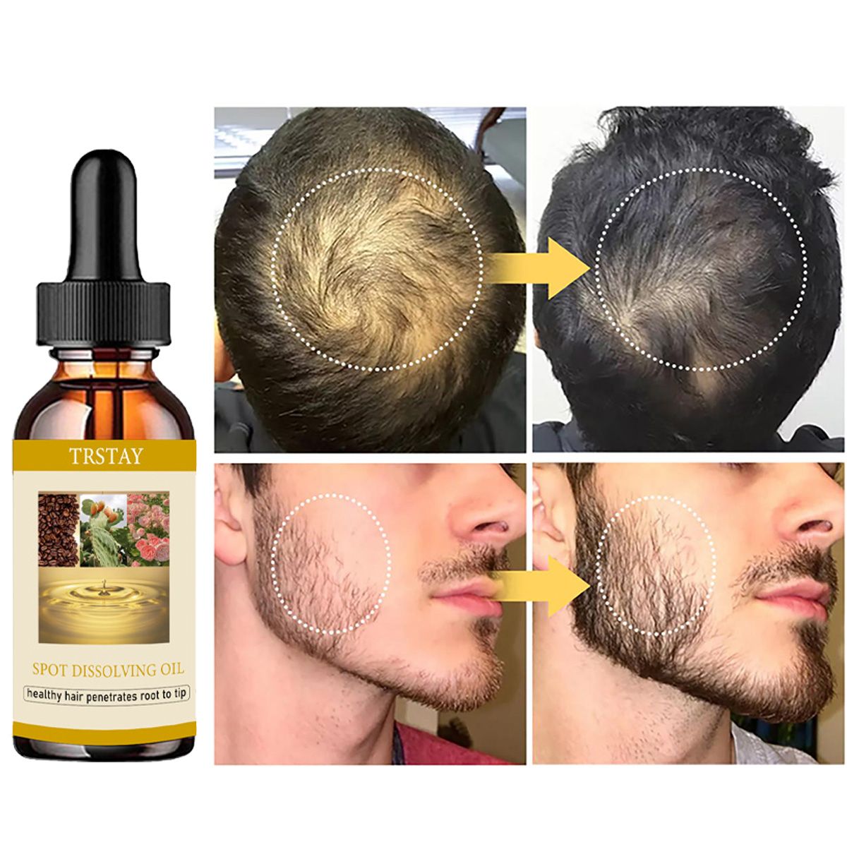 50ML Beard Growth Oil Anti Alo - Beard Oil Growth ulasan dan harga