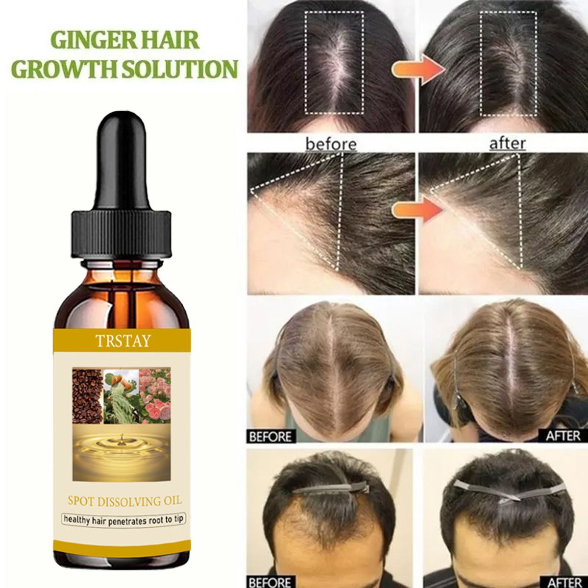 50ML Beard Growth Oil Anti Alo - Beard Oil Growth ulasan dan harga