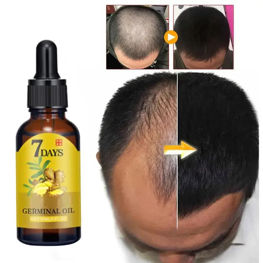 Hair Growth Ginger Fast Growin - Beard Oil Growth ulasan dan harga