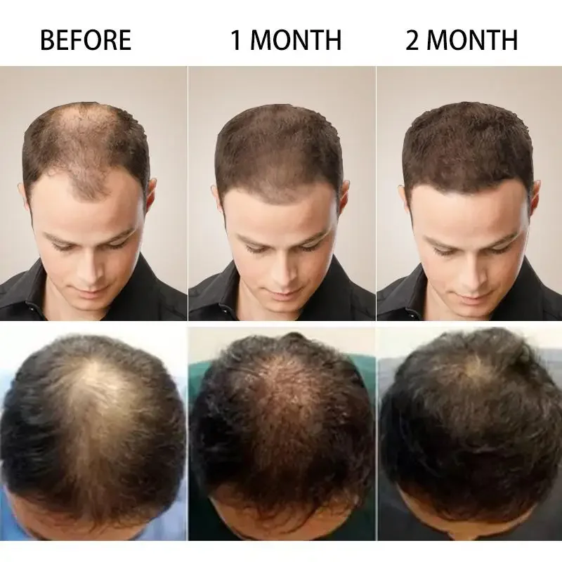 Hair Growth Ginger Fast Growin - Beard Oil Growth ulasan dan harga