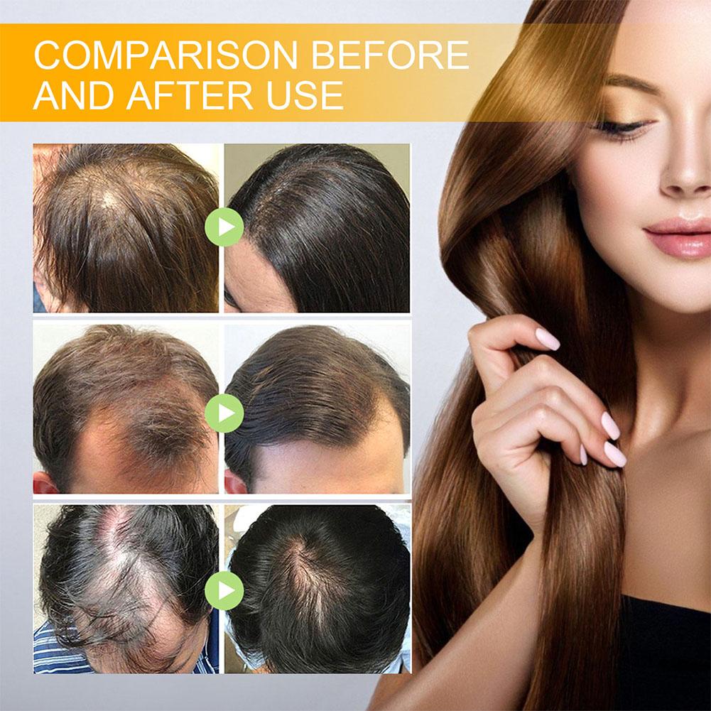 5/3/1pcs Biotin Fast Hair Grow - Beard Oil Growth ulasan dan harga